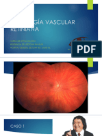 09 Retina Vascular