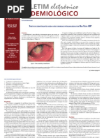 INVESTIGAÇÃO DE SURTO - INVESTIGAÇÃO ENDOFTALMITE