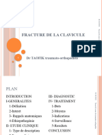 02 Fracture de La Clavicule