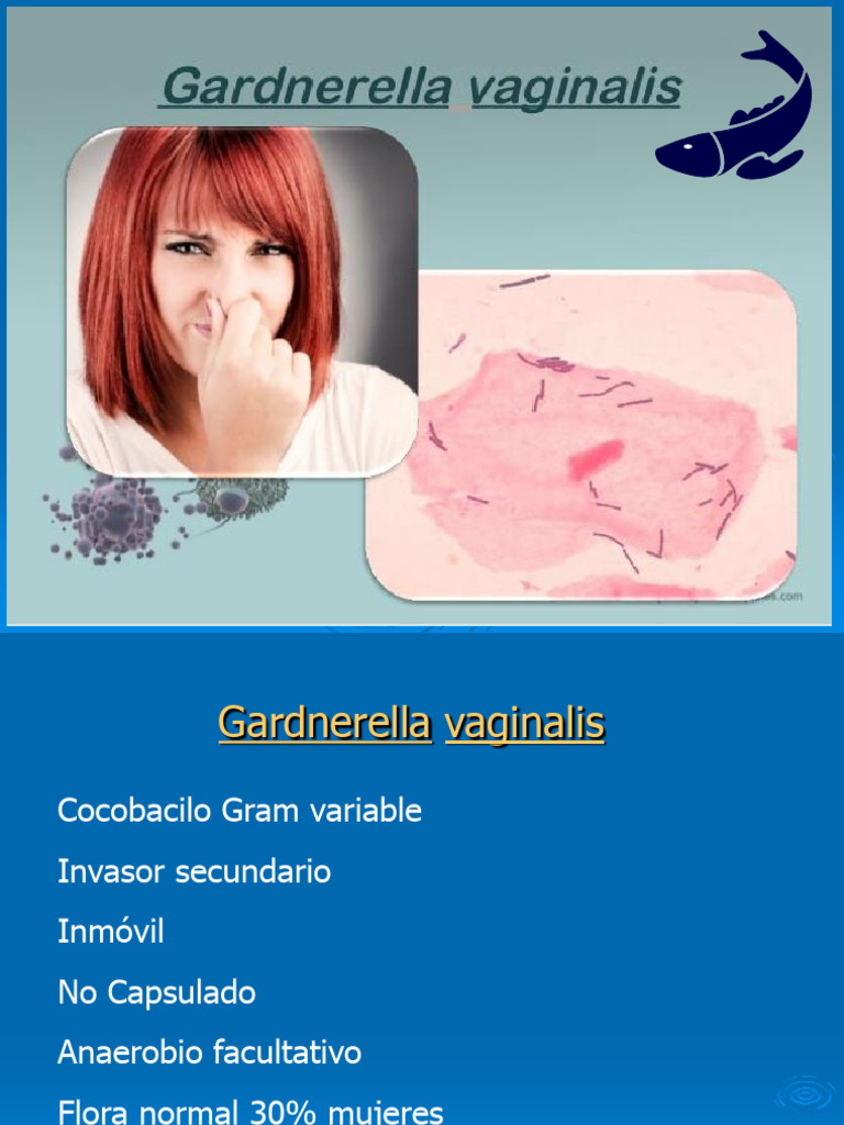 Gardnerella vaginalis y vaginosis bacteriana | PDF