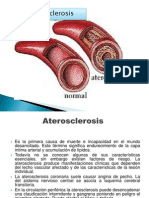 Aterosclerosisdiapositivas 110426002157 Phpapp02
