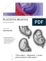 placenta pravia (1) (1)