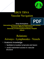 EBUS TBNA Navigation