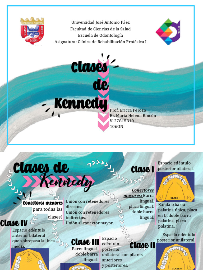 Clases de Kennedy | PDF