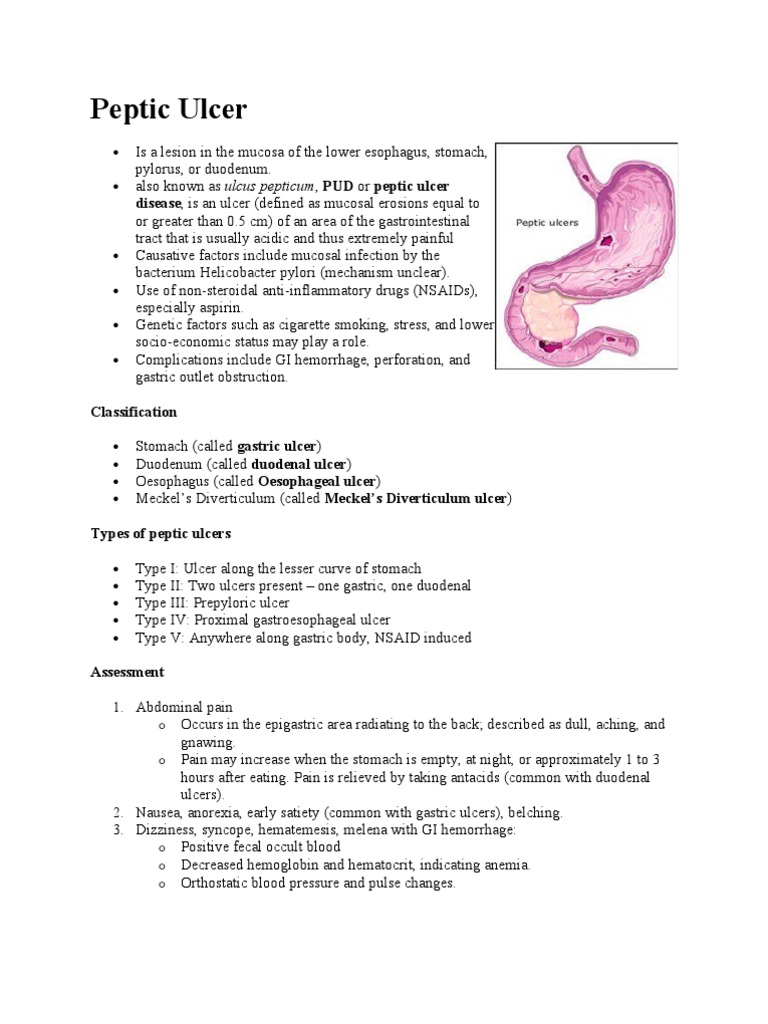 Peptic ulcer disease case study answers image