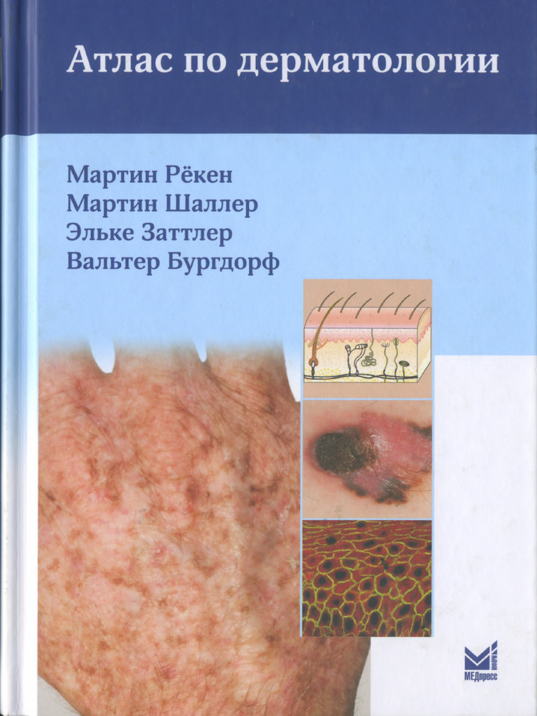 Атлас по дерматологии | PDF