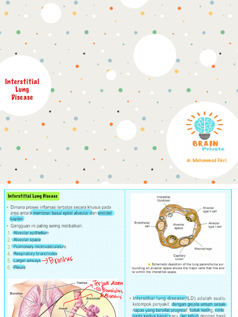 Interstitial Lung Disease | PDF