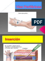 Técnic Colocación Vía Periférica GLEW