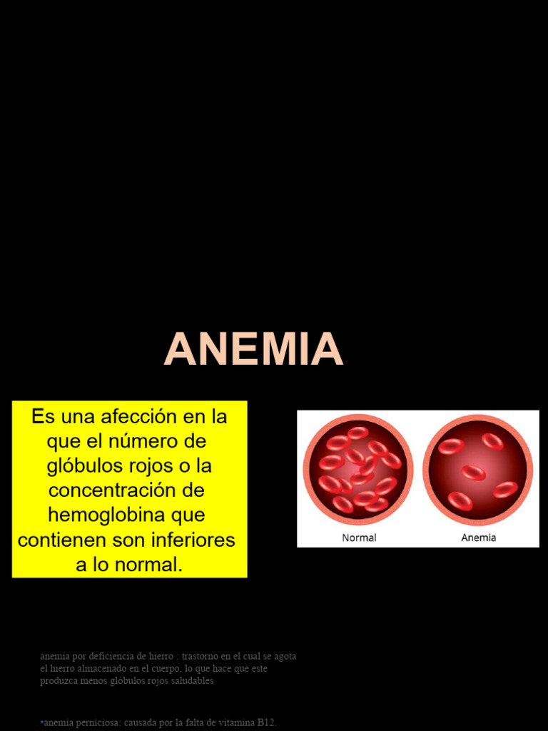 Anemia PDF