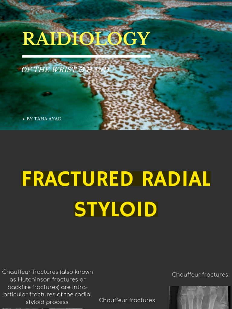 Ortho XRAY Part 2 PDF