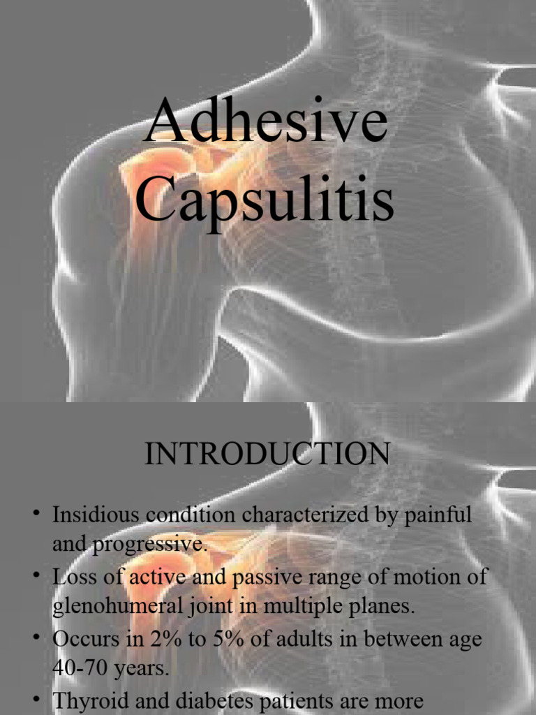 Adhesive Capsulitis PDF