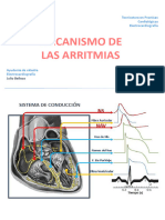 Mecanismo de Arritmias