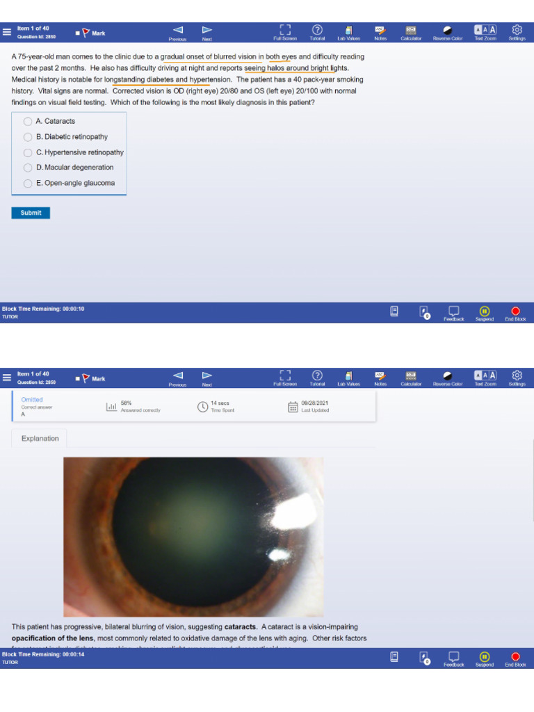 Ophthalmology 53q | PDF