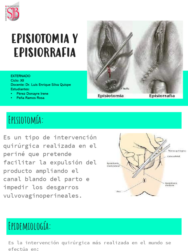 Diferencias entre Episiotomía y Episiorrafia | PDF