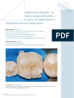 Evidence-Based Concepts and Procedures For Bonded Inlays and Onlays. Part III (TRADUCIDO)