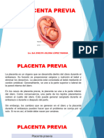 Placenta Previa