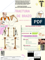Fractura de Brazo