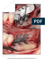 Int J Periodontics Restorative Dent 2011 Ronda