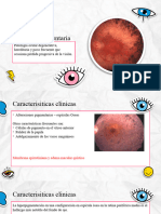 RP Pigmentaria y Prematura