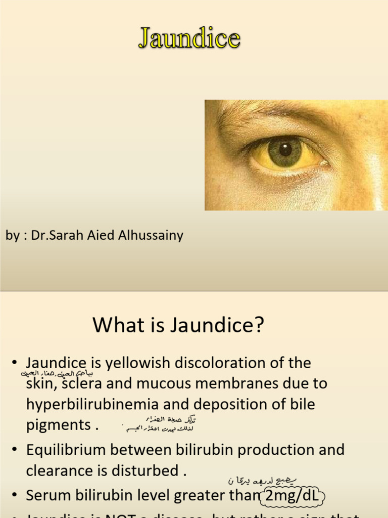 Jaundice PDF