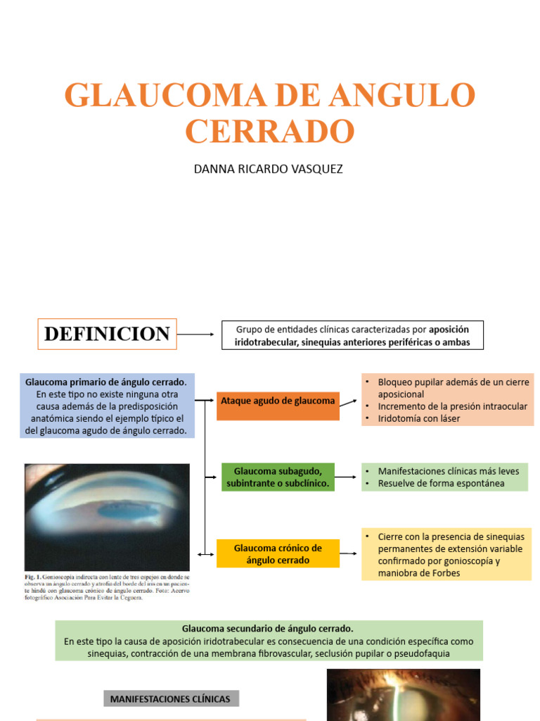 Glaucoma de Angulo Cerrado | PDF, image size:768x1024