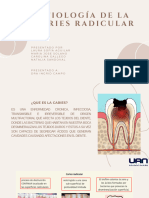 Caries Radicular