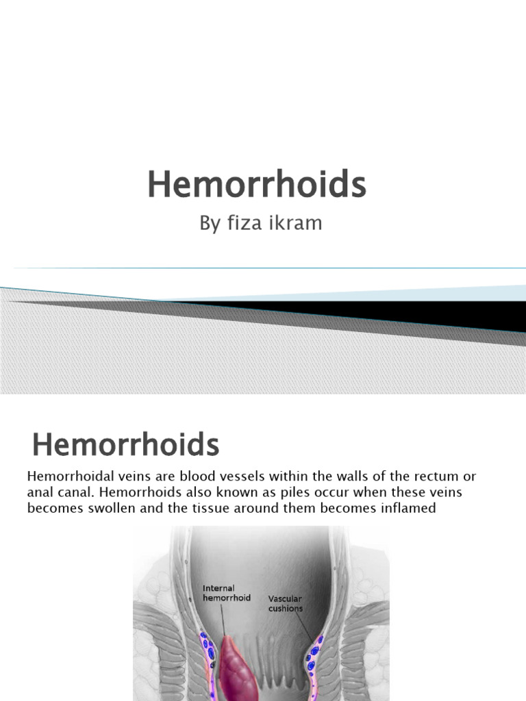 Hemorrhoids 1 PDF Hemorrhoid Causes Of Death