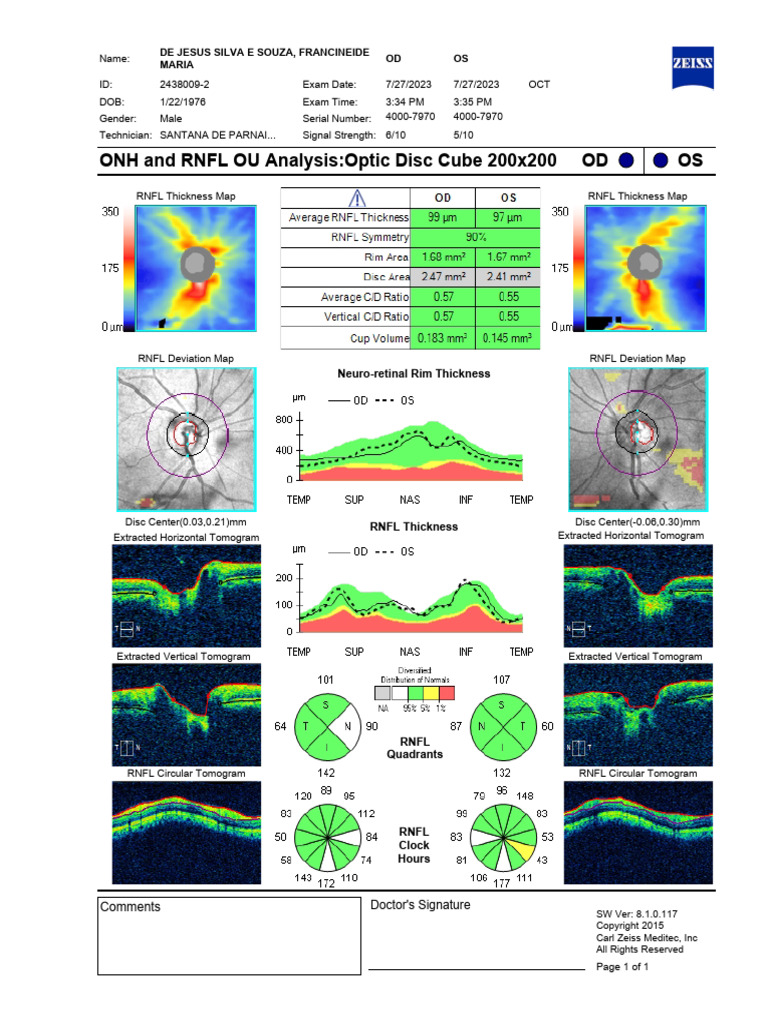 OS OD ONH and RNFL OU AnalysisOptic Disc Cube 200x200 de Jesus Silva