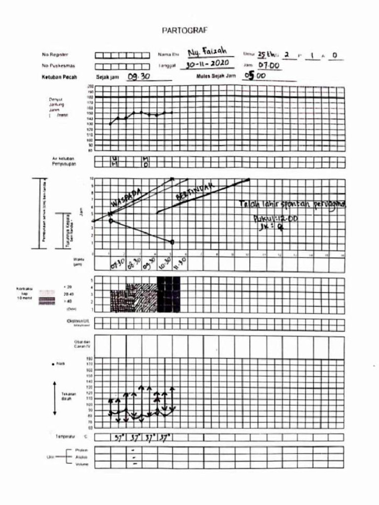 Partograf | PDF