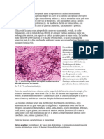 La Escabiosis o Sarna Corresponde A Una Ectoparasitosis Cutánea Intensamente Pruriginosa y Contagiosa