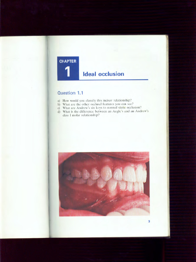 Atlas of Orthodontics | PDF