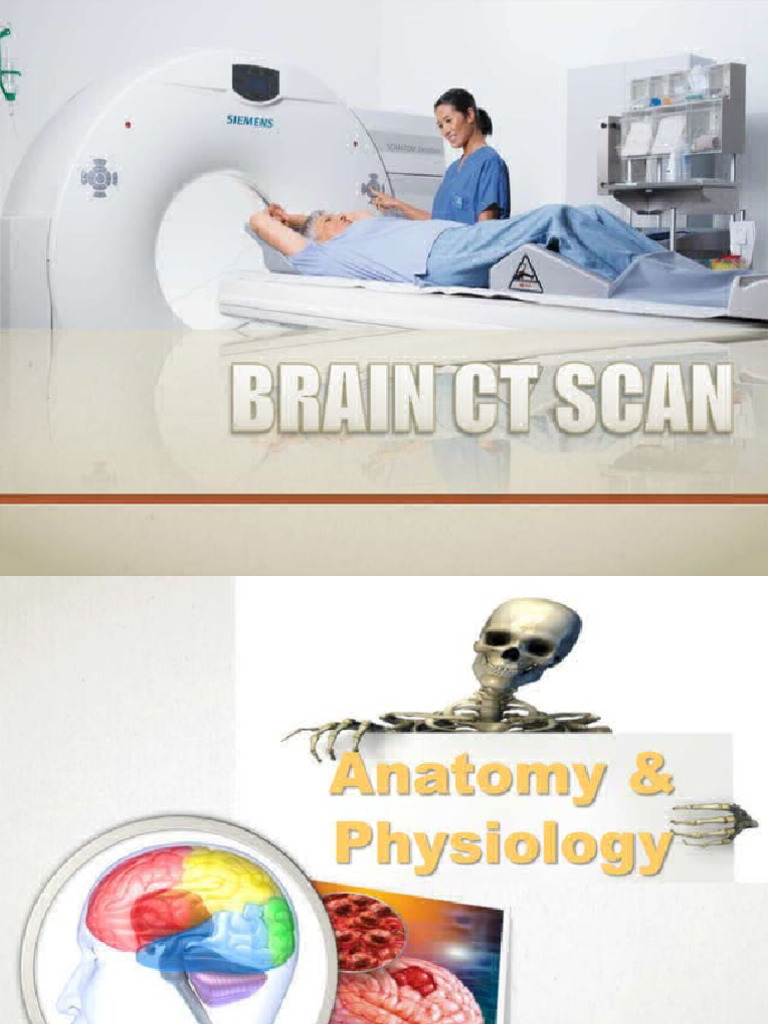 CT Brain | PDF