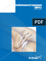 Medial Patellofemoral Ligament MPFL