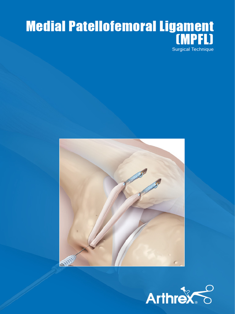 MPFL Reconstruction Surgical Technique | PDF | Knee | Lower Limb Anatomy