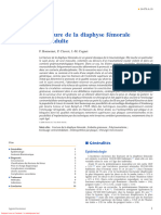 Fracture de la diaphyse fémorale de l’adulte