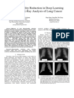 Dimensionality Reduction in Deep Learning For Chest X-Ray Analysis of Lung Cancer