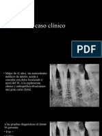 Caso Clínico Diagnosticos