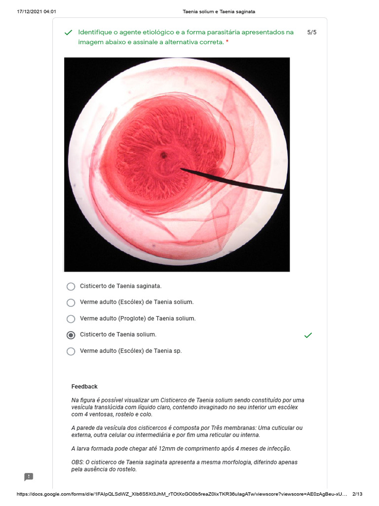 RELATO DE OCORRÊNCIA DE CISTICERCOSE EM CARCAÇA SUÍNA NA REGIÃO CENTRAL DO  ESTADO DE RONDÔNIA, image size:768x1024