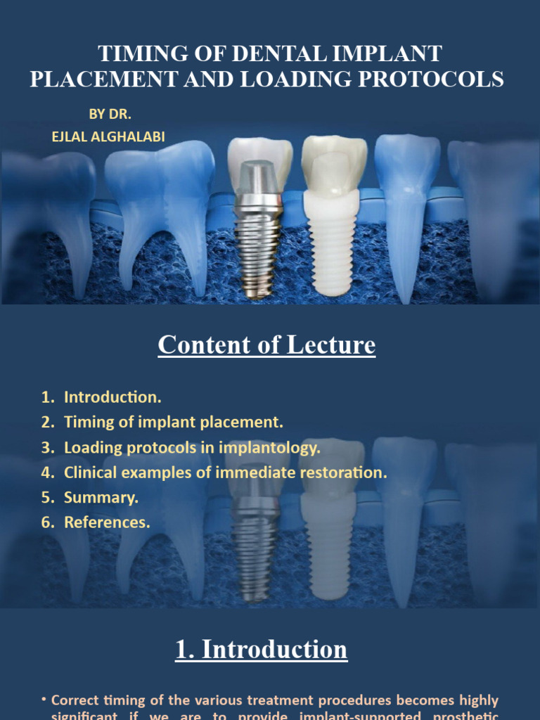 Timing of Dental Implant Placement and Loading Protocols Completion
