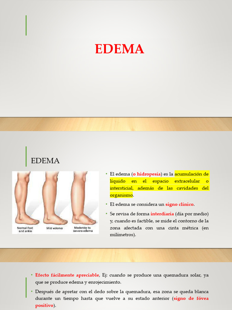 Edema | PDF | Edema | Medicina CLINICA