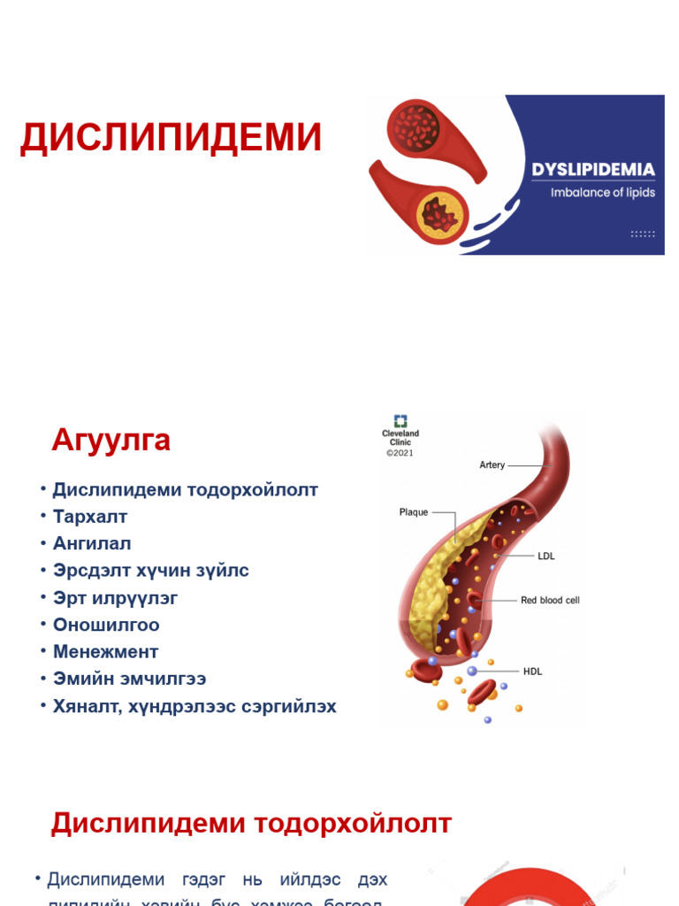 Dyslipidemia khulan pdf