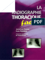 La Radiographie Thoracique Facile
