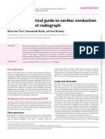 How To: A Practical Guide To Cardiac Conduction Devices On Chest Radiograph