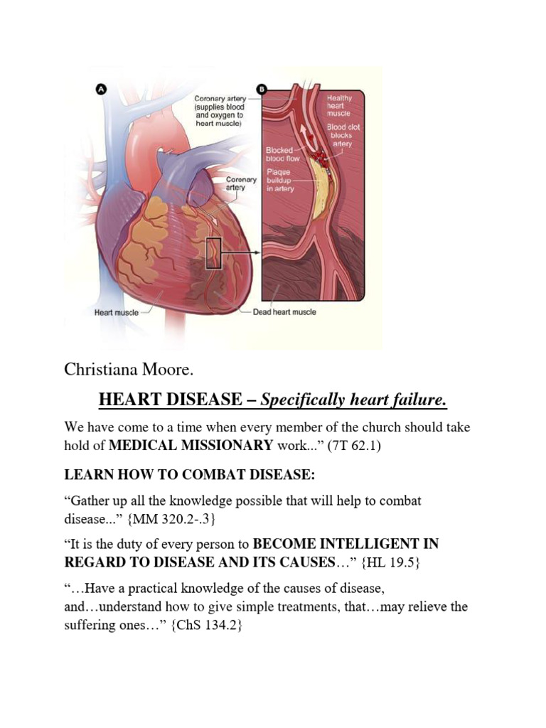 Understanding Heart Failure Causes | PDF | Heart | Coronary Artery Disease