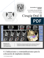 Eje 4.cirugía Oral I - Implantes Dentales.