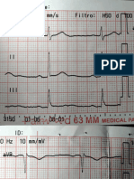 Trazo SINUSAL EKG