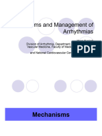 Mechanism and Management Arrhythmias