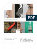 State of The Art Rhinoplasty Techniques - Perspectives From Korean Masters (2021, Springer) - Man Koon SUH - PDF-302-350