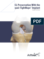 Acl Preservation With The Acl Repair Tightrope Implant