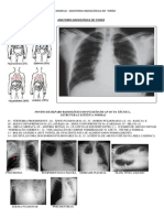 Anatomia Radiológica - Prancha Tórax Ii (Prof. Amarildo)